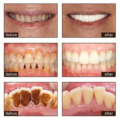 💥HUGE DISCOUNT - 50% OFF! LIMITED TIME! LOVILDS™ Niacinamide Whitening Toothpaste for a Bright Smile.💪 GRAB IT NOW!
